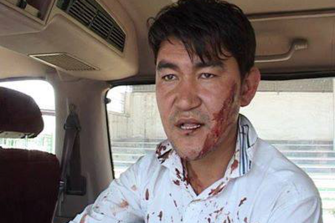 62 cases of violence against journalists recorded in Afghanistan