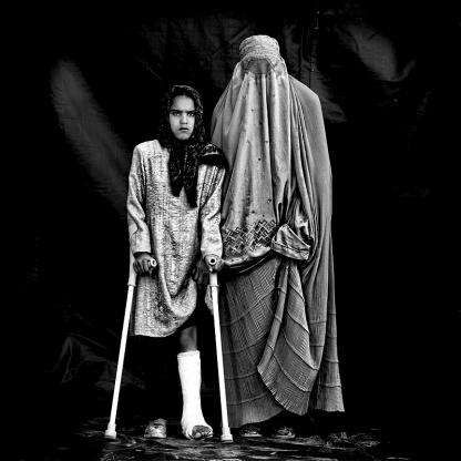 مجموعه عكس" قربانيان جنگ افغانستان" در هالند به نمايش گذاشته شد