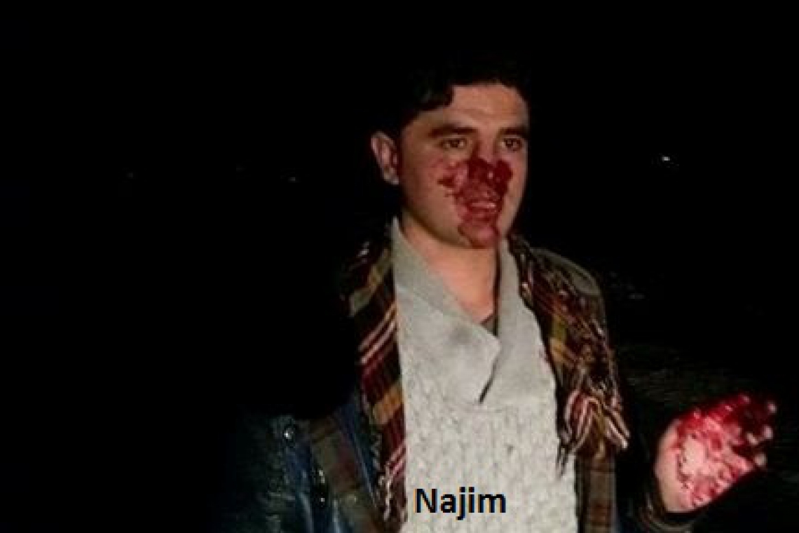 په کندز کې د دوه سيمه ئيزو خبريالانو وهل ټکول