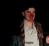 په کندز کې د دوه سيمه ئيزو خبريالانو وهل ټکول